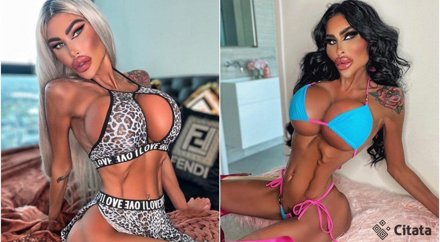 Moteris grožio procedūroms išleidžia šimtus tūkstančių: parodė, kaip atrodė anksčiau