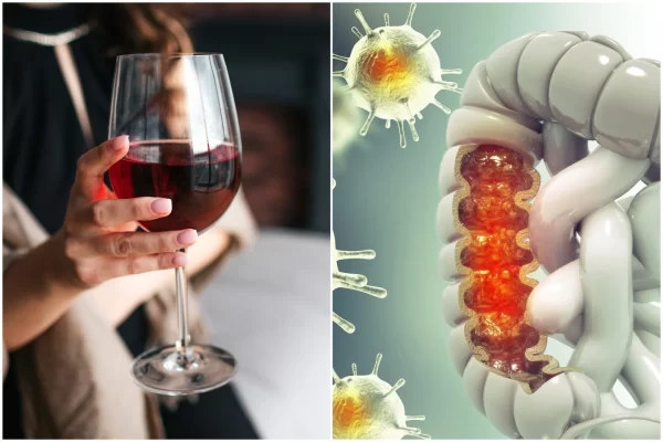 Balta duona ir alkoholis didina storosios žarnos vėžio riziką: ką rodo naujausi tyrimai?